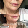PDRN Balm Stick