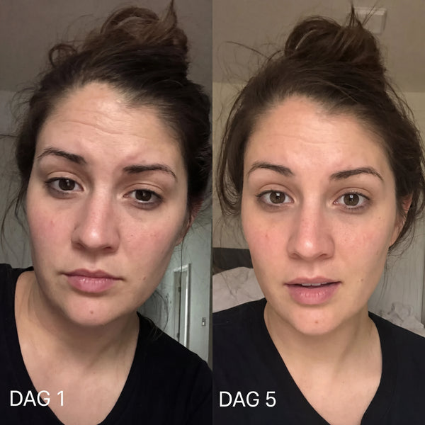 före och efter